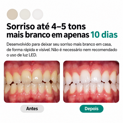 Opalescence Go Clareador Dental 15% Peróxido de Hidrogênio – Kit com 7 Aplicações, Moldeiras Pré-Preenchidas + Creme Dental para Dentes Sensíveis 28 g – Menta